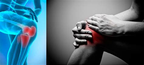 Как справиться с болью в коленном суставе